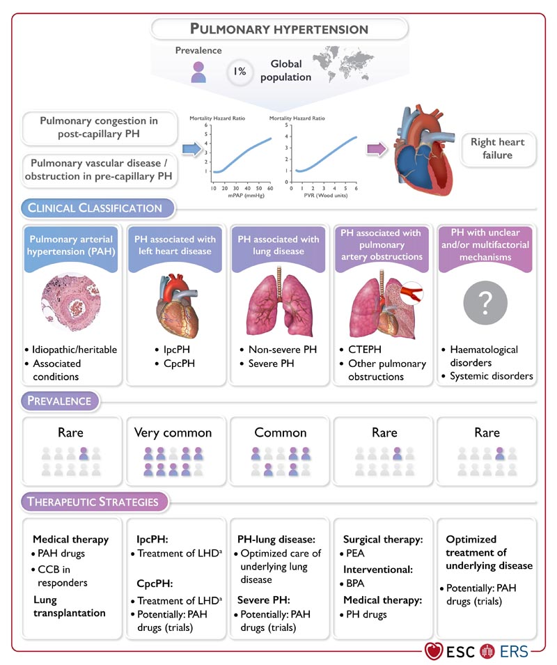 L’hypertension pulmonaire nécessite un diagnostic plus précoce