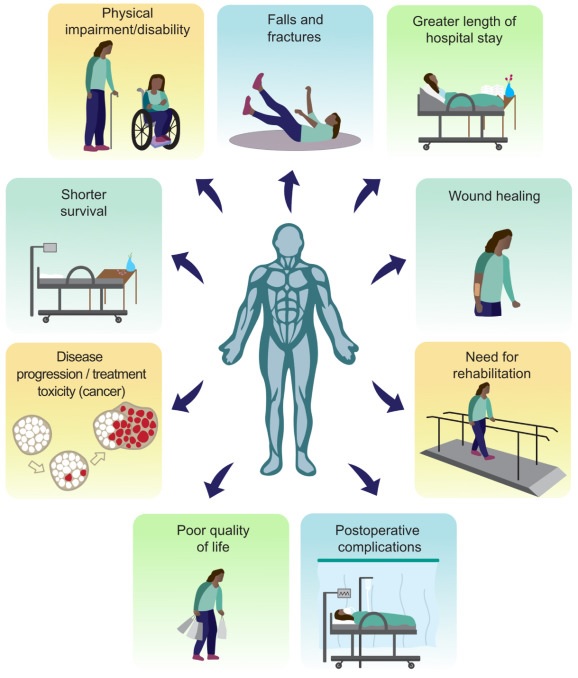 Santé musculaire et nutrition