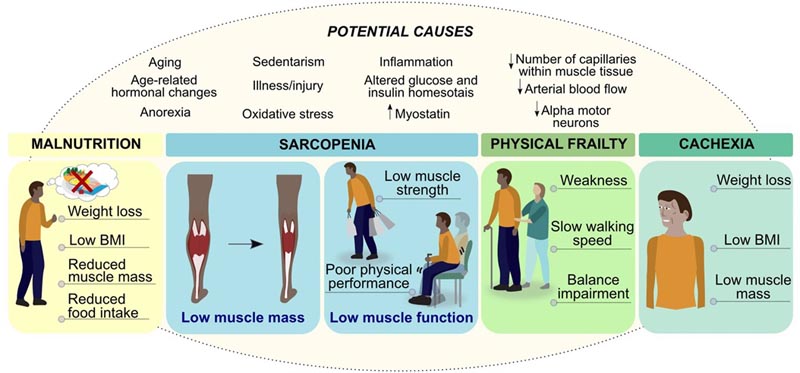 Santé musculaire et nutrition