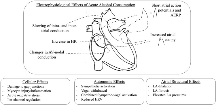 Understanding the Relationship Between Atrial Fibr