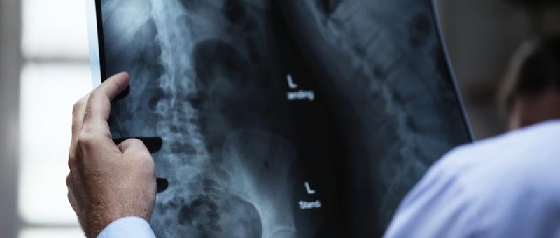 Utilisation excessive des tests de diagnostic : défis et