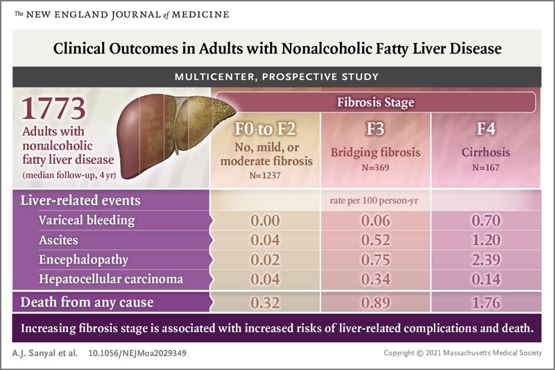 Evoluzione della malattia del fegato grasso non al