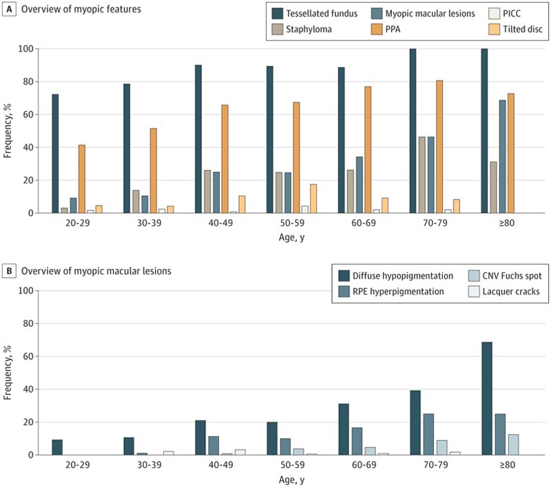Fattori associati alla miopia nella popolazione ol