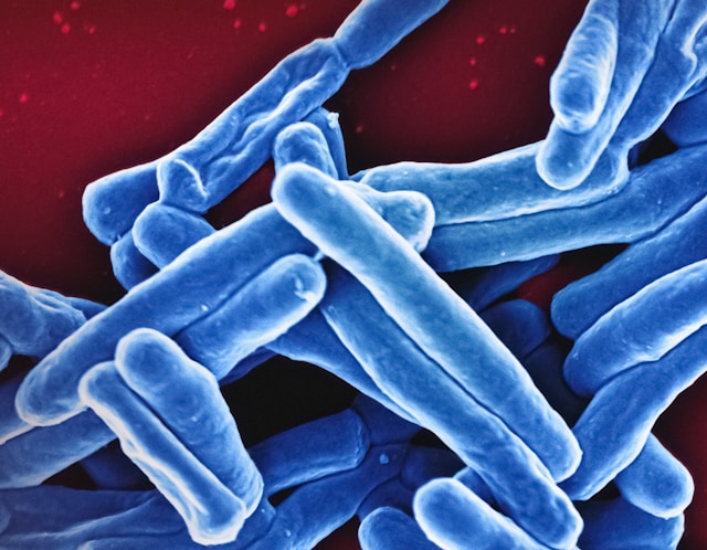 New Study Unveils Effective TB Prevention Strategy