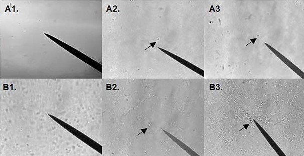 Environmental Microplastics Enter the Body