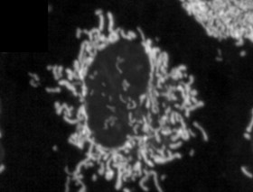 Mitochondrial Fragmentation: Implications for Obes